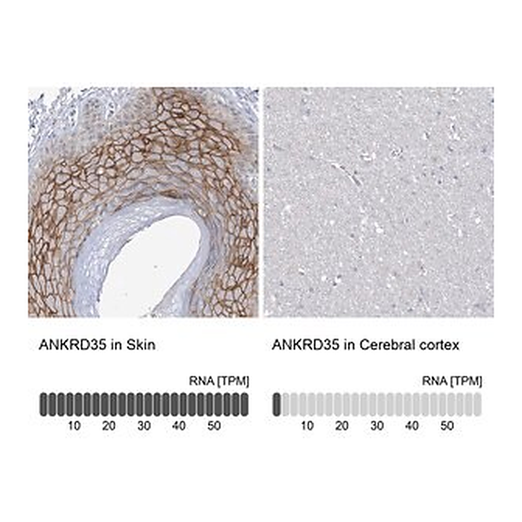 Merck Anti-ANKRD35 antibody produced in rabbit