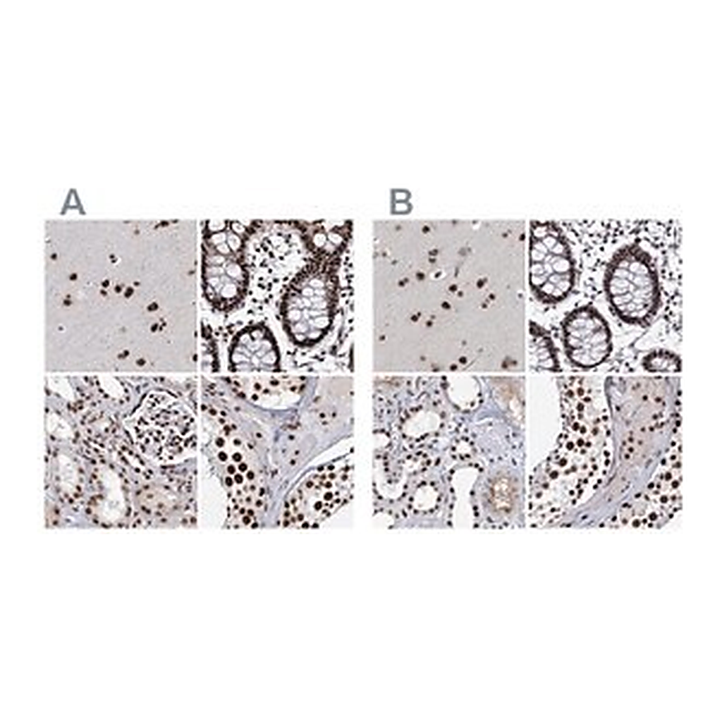 Merck Anti-SCAF8 antibody produced in rabbit
