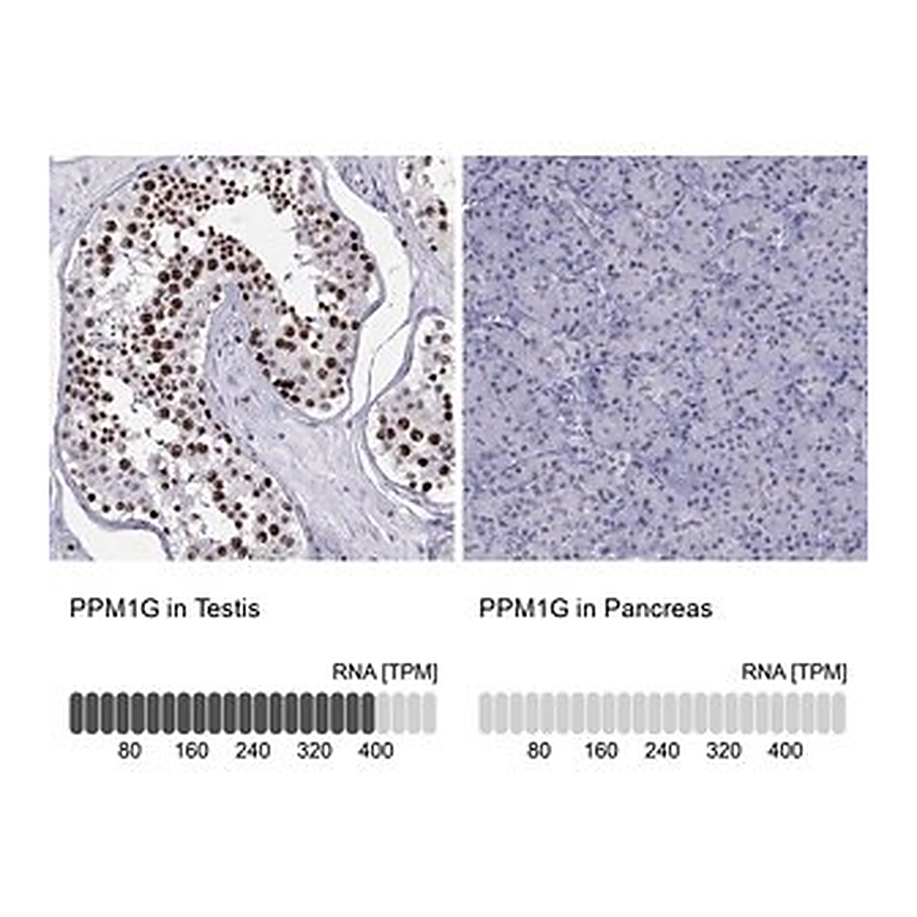 Merck Anti-PPM1G antibody produced in rabbit