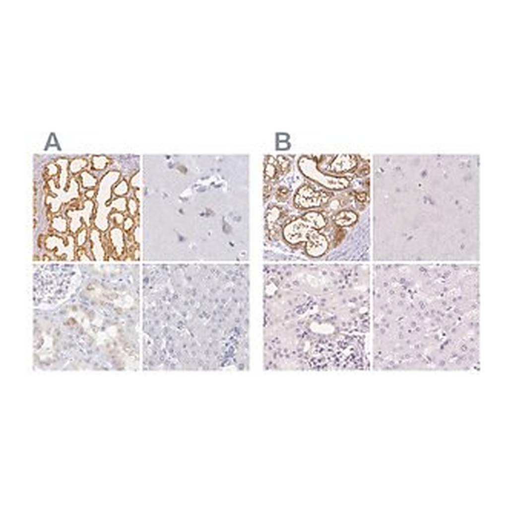 Merck Anti-CSN1S1 antibody produced in rabbit