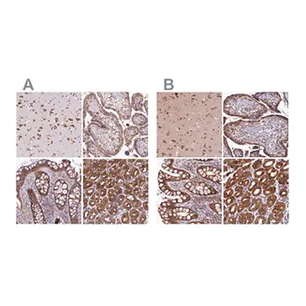 Merck Anti-QARS antibody produced in rabbit