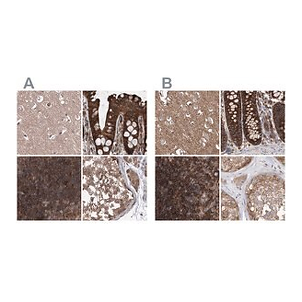 Merck Anti-VPS37B antibody produced in rabbit