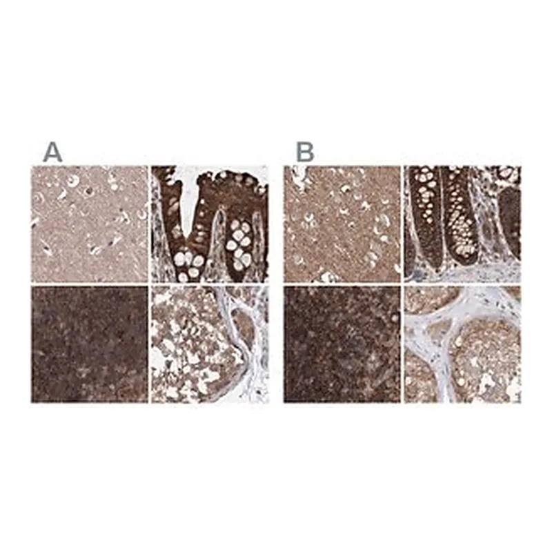 Merck Anti-VPS37B antibody produced in rabbit