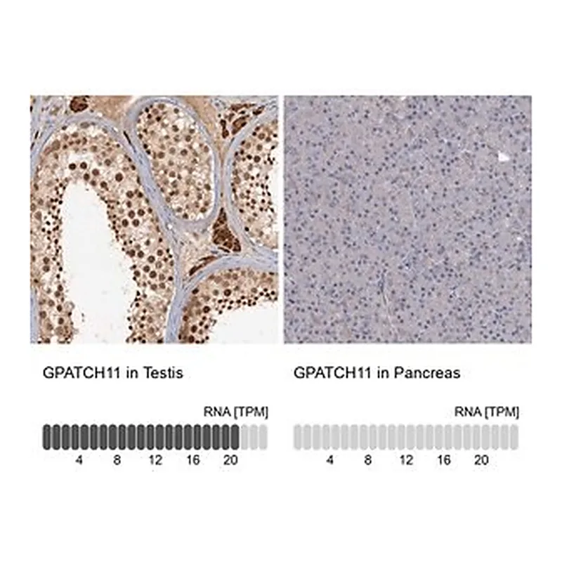 Merck Anti-GPATCH11 antibody produced in rabbit