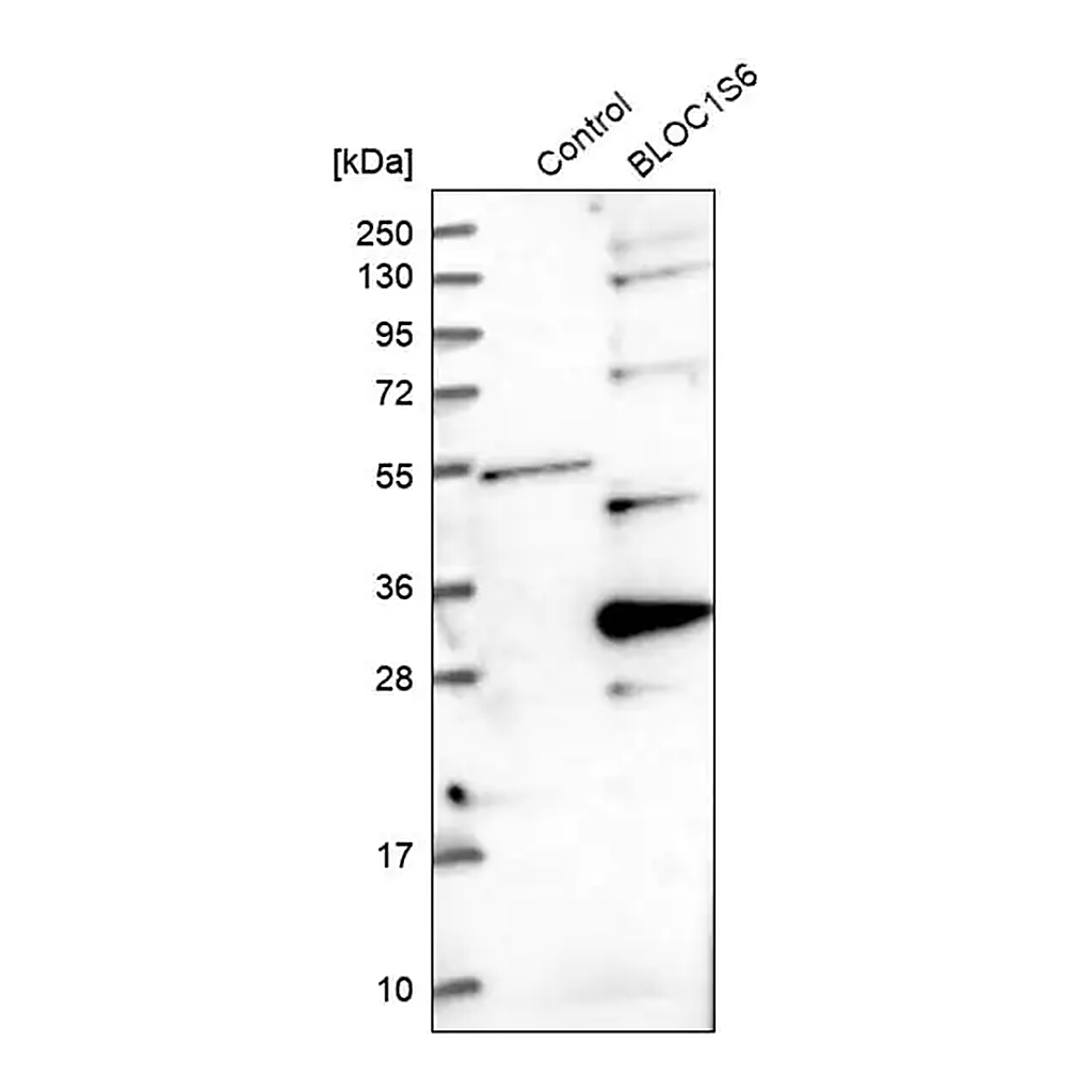 Merck Anti-BLOC1S6 antibody produced in rabbit