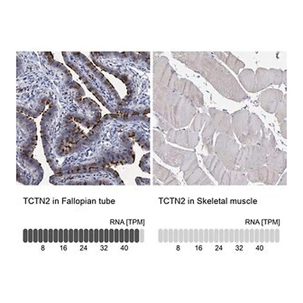 Merck Anti-TCTN2 antibody produced in rabbit