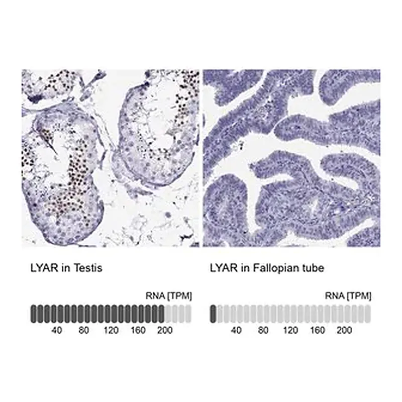 Merck Anti-LYAR antibody produced in rabbit
