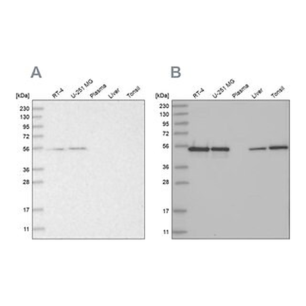 Merck Anti-RBM17 antibody produced in rabbit
