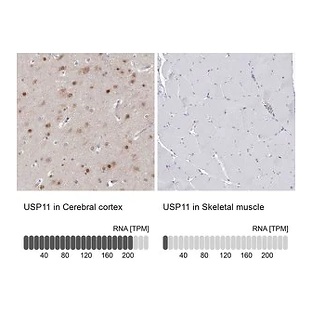 Merck Anti-USP11 antibody produced in rabbit