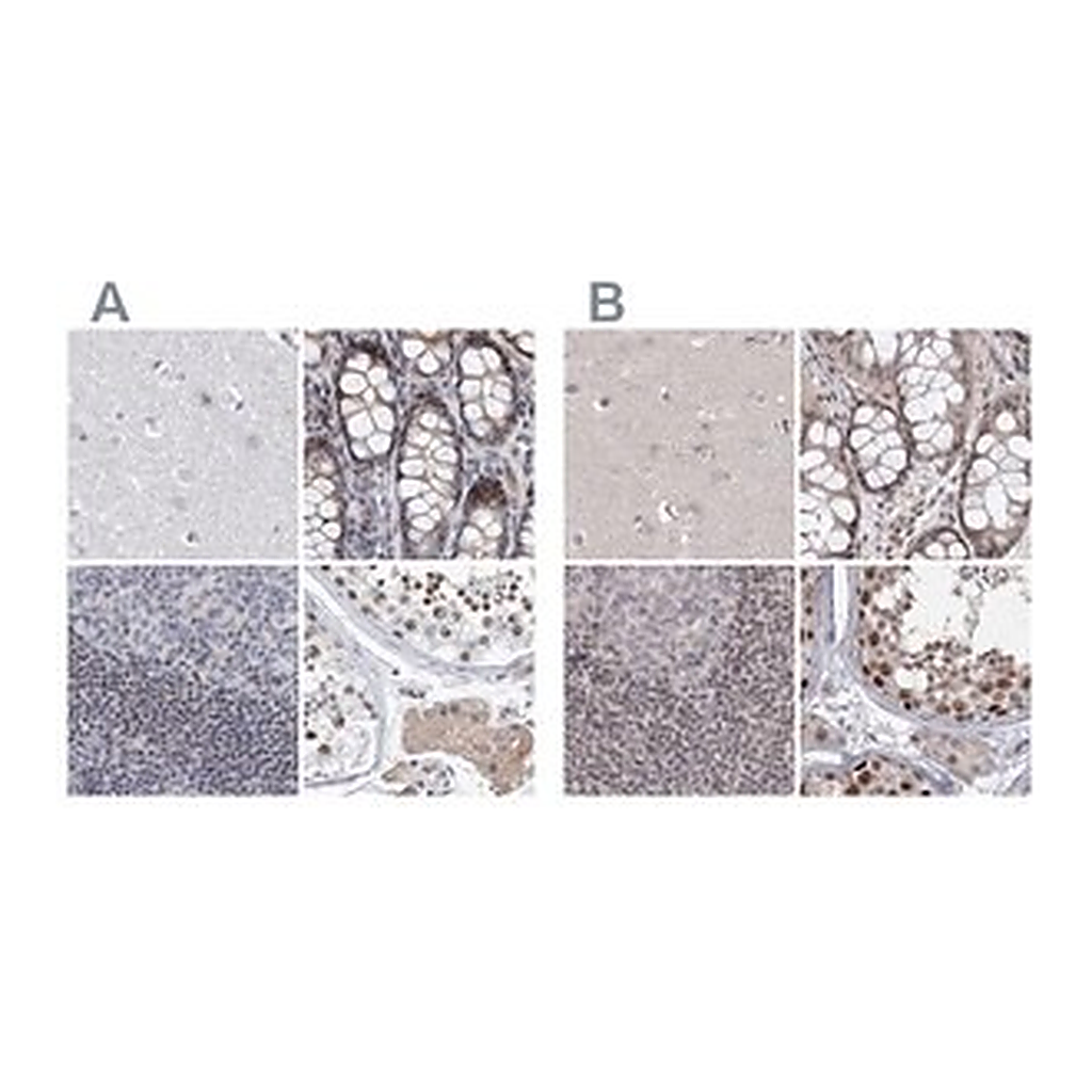 Merck Anti-UIMC1 antibody produced in rabbit