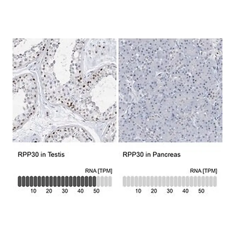 Merck Anti-RPP30 antibody produced in rabbit