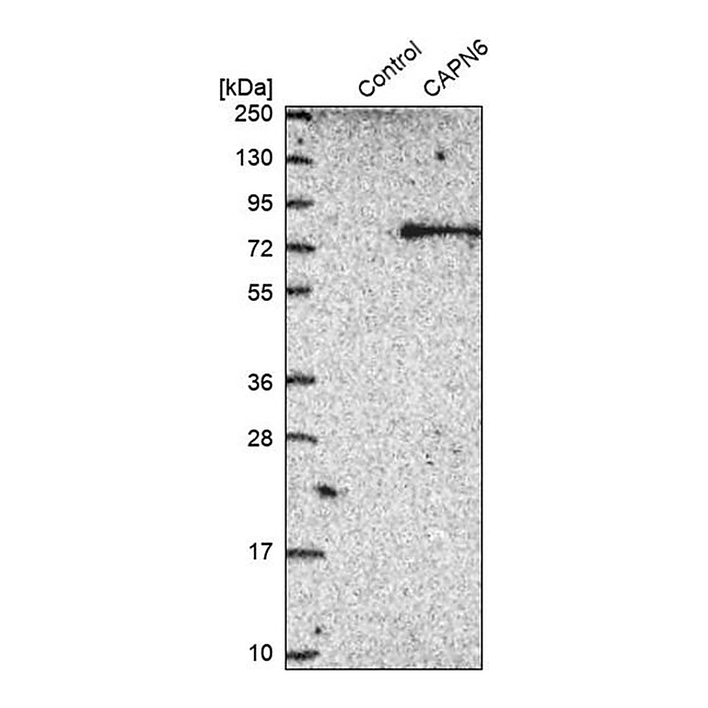 Merck Anti-CAPN6 antibody produced in rabbit