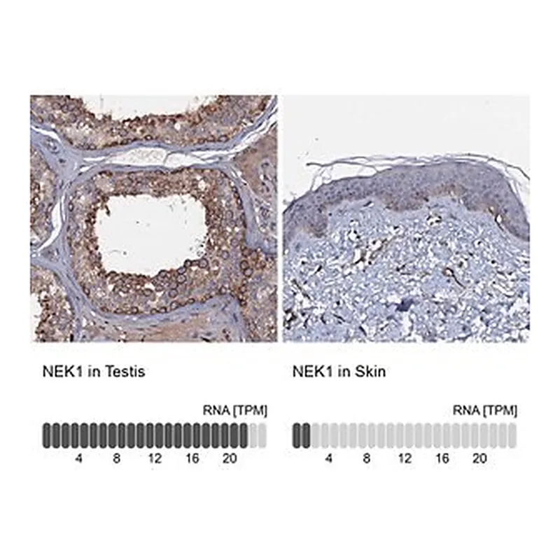 Merck Anti-NEK1 antibody produced in rabbit