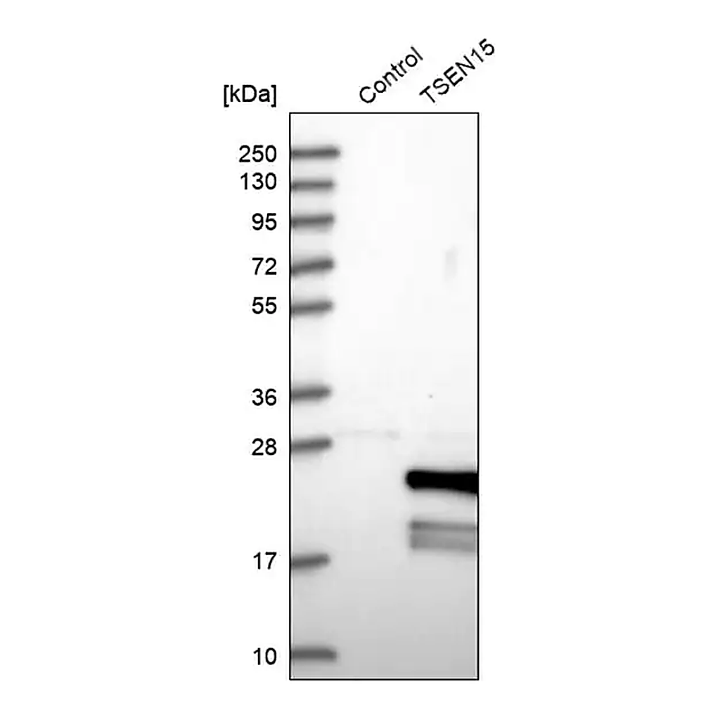 Merck Anti-TSEN15 antibody produced in rabbit