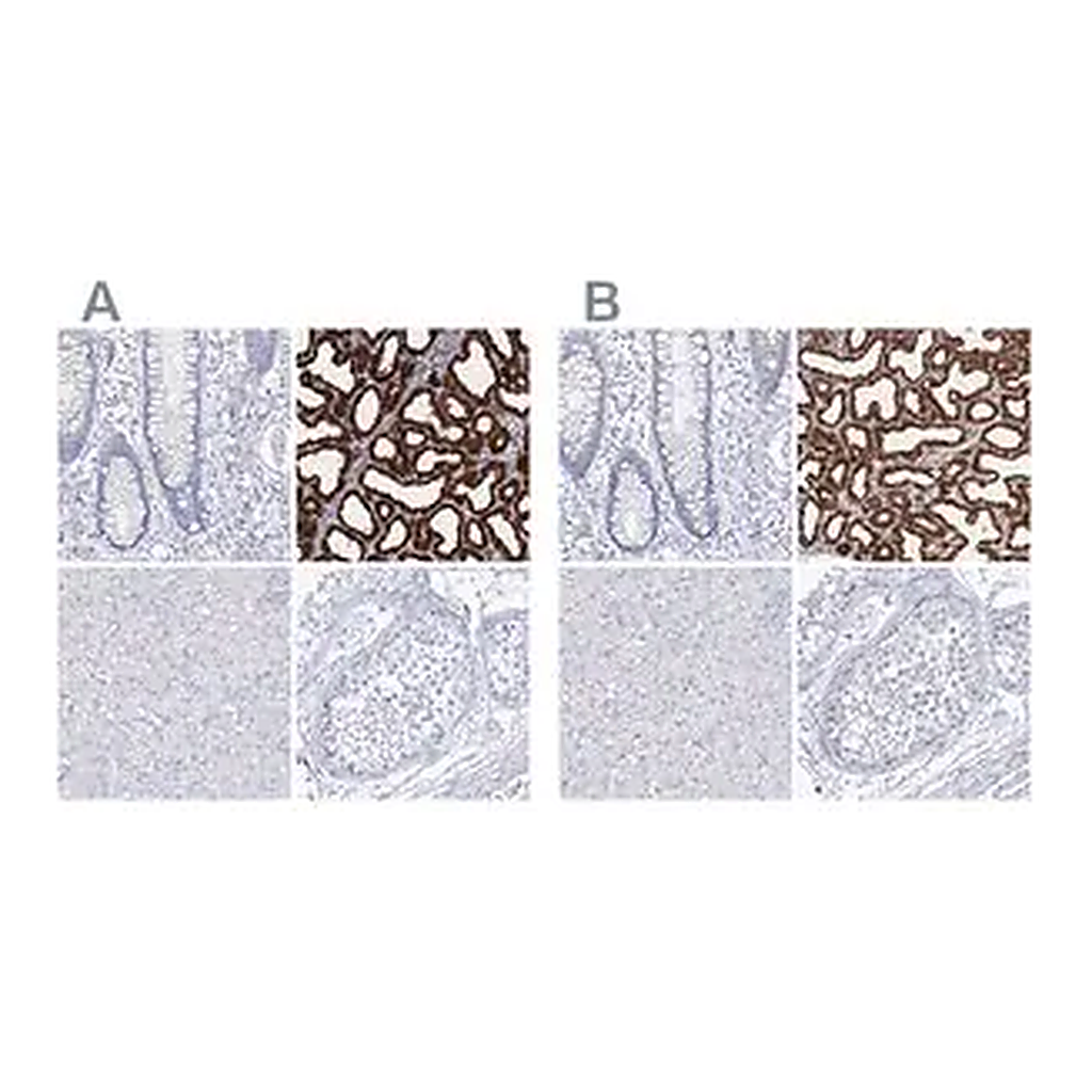 Merck Anti-CSN3 antibody produced in rabbit