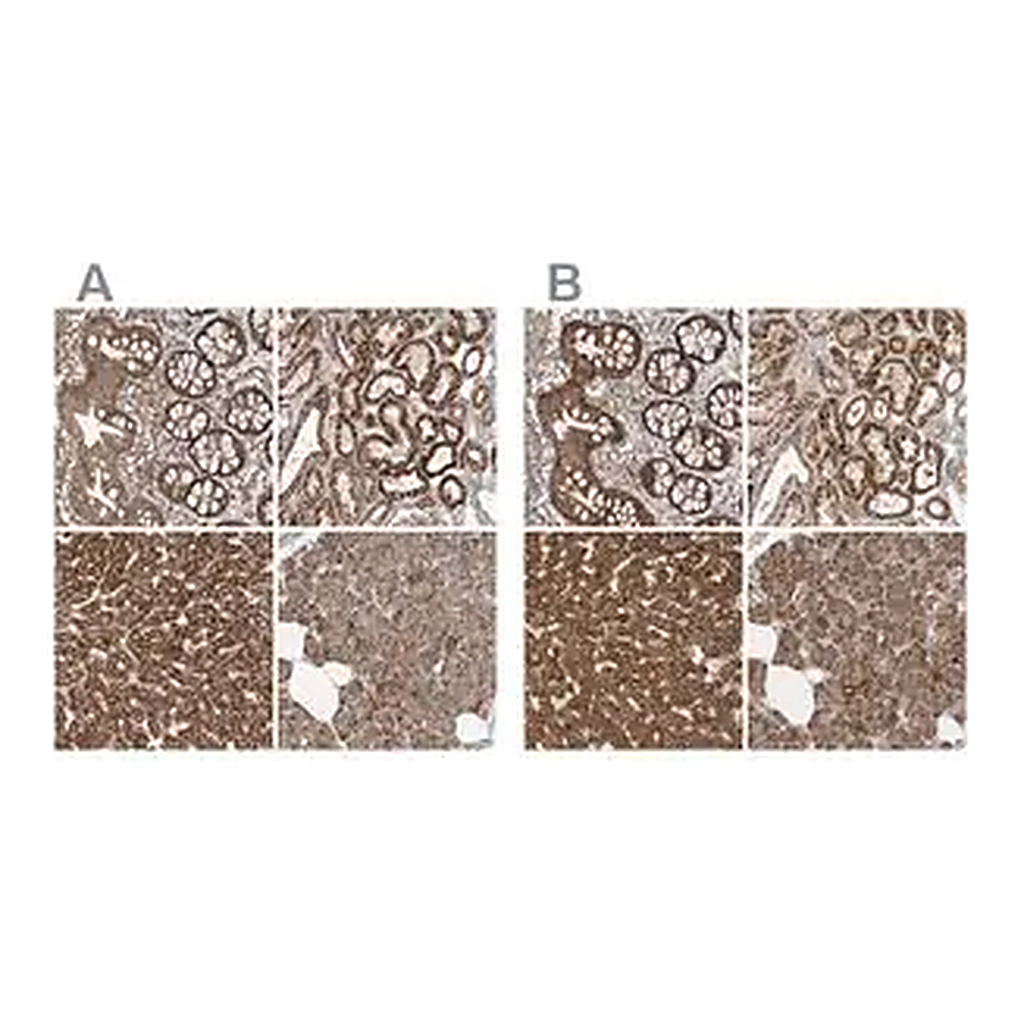 Merck Anti-MUT antibody produced in rabbit