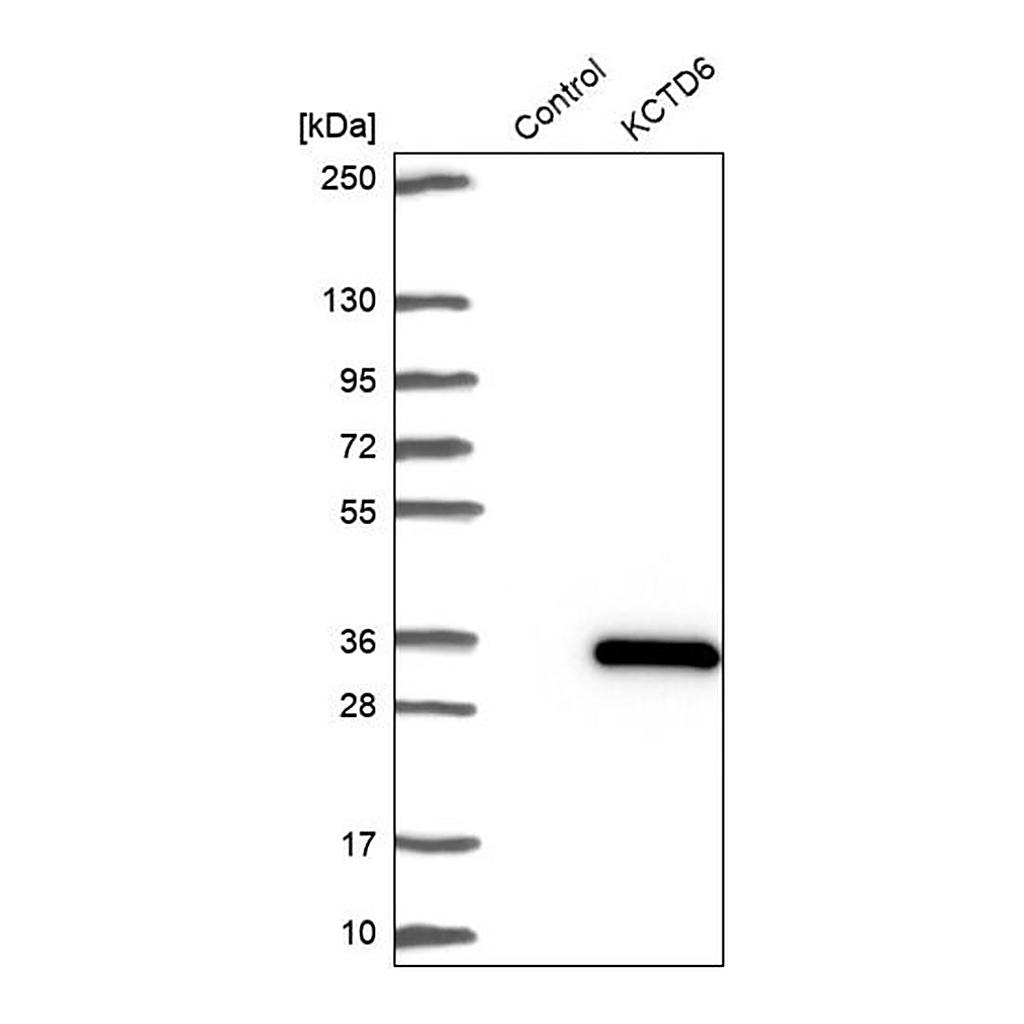 Merck Anti-KCTD6 antibody produced in rabbit