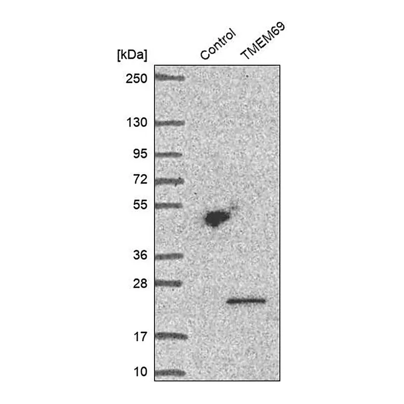 Merck Anti-TMEM69 antibody produced in rabbit