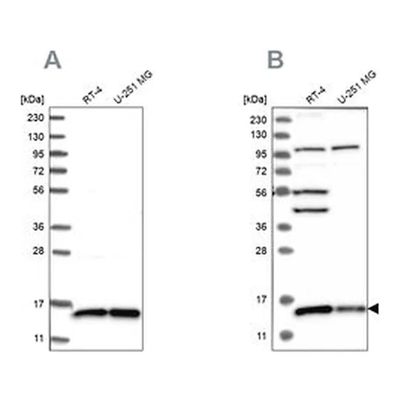 Merck Anti-FAM136A antibody produced in rabbit