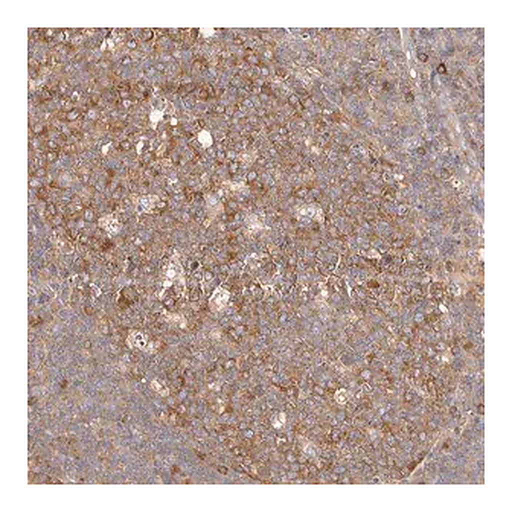 Merck Anti-EPRS antibody produced in rabbit
