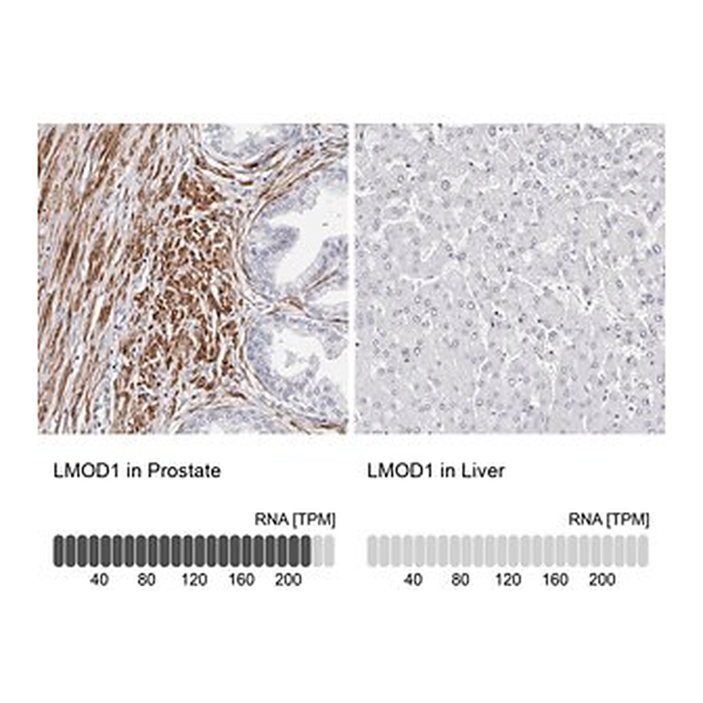 Merck Anti-LMOD1 antibody produced in rabbit