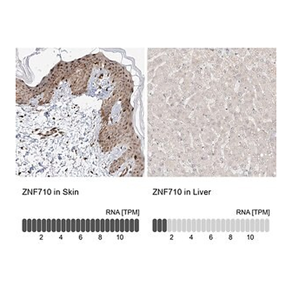 Merck Anti-ZNF710 antibody produced in rabbit