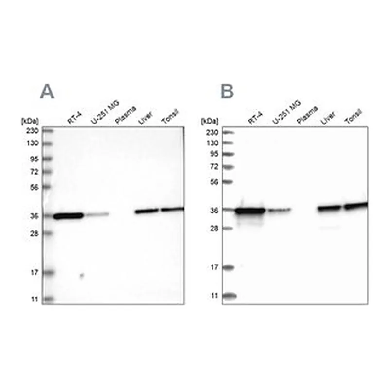 Merck Anti-PDXK antibody produced in rabbit