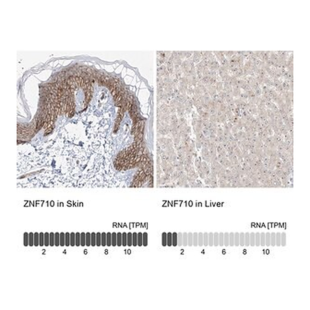 Merck Anti-ZNF710 antibody produced in rabbit