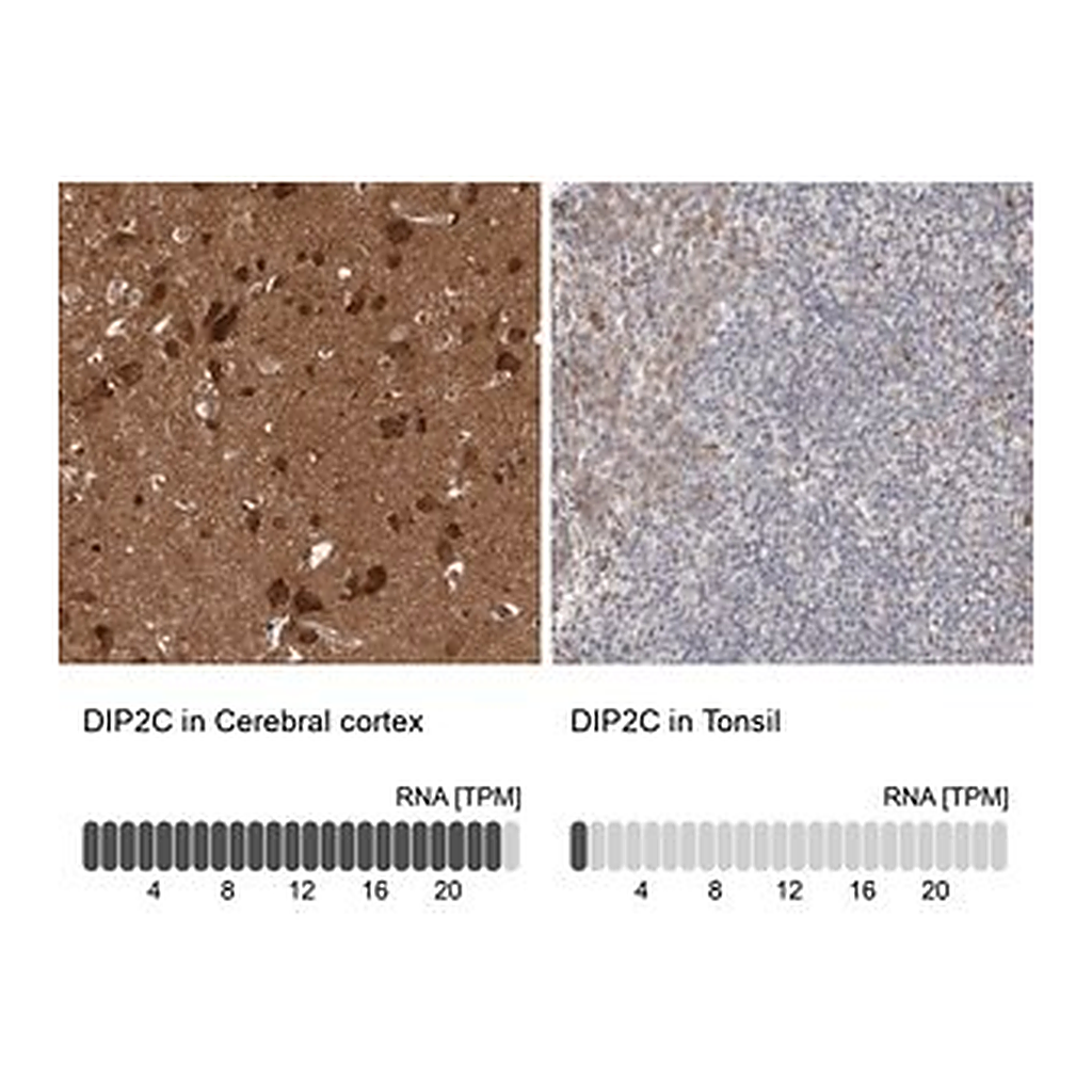 Merck Anti-DIP2C antibody produced in rabbit