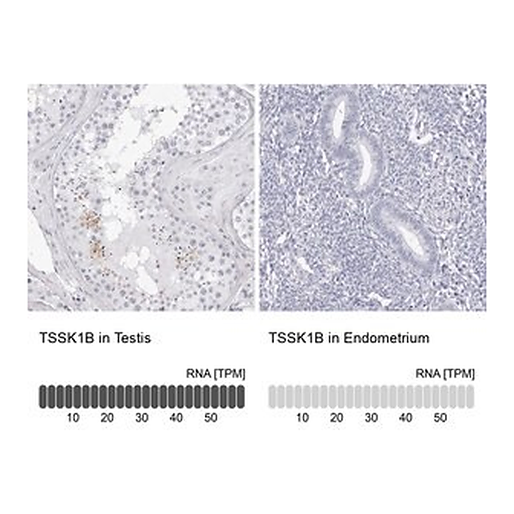 Merck Anti-TSSK1B antibody produced in rabbit