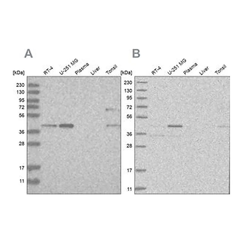 Merck Anti-RTCA antibody produced in rabbit