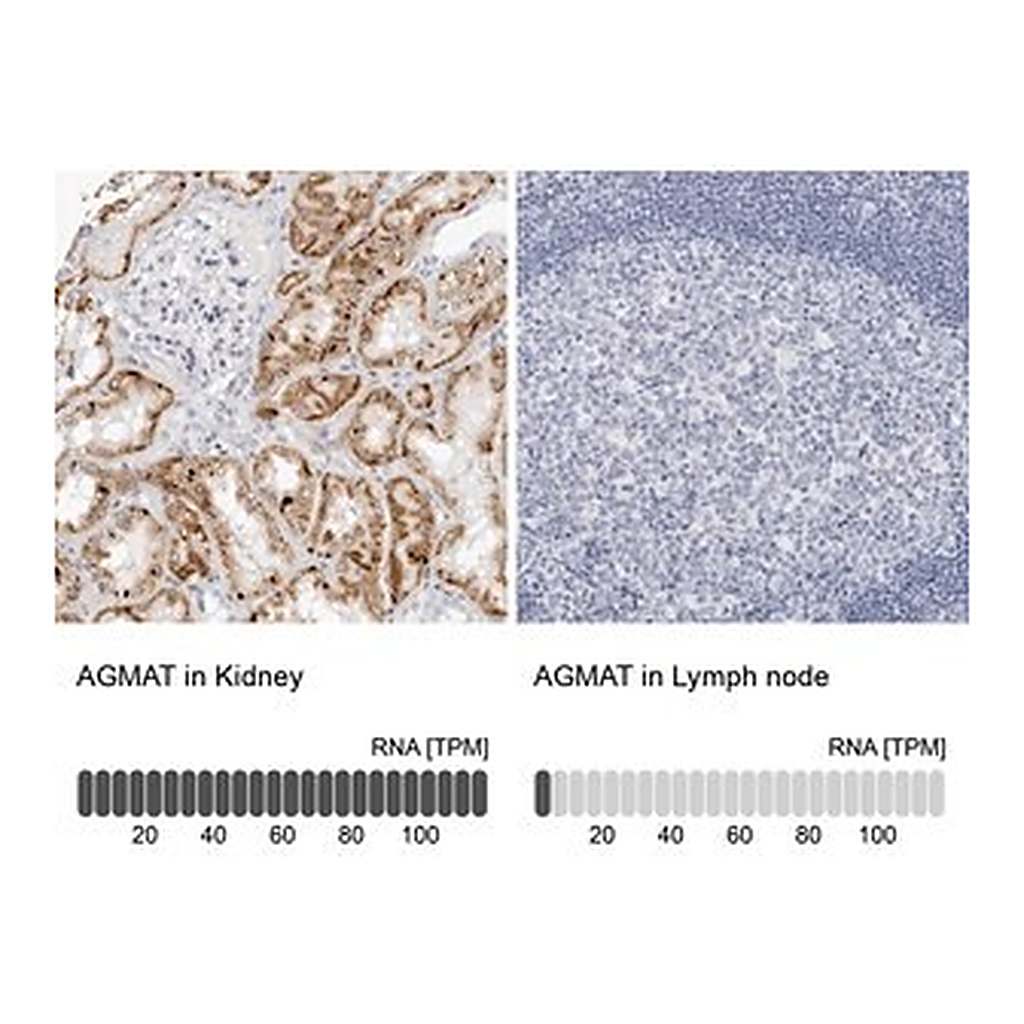 Merck Anti-AGMAT antibody produced in rabbit