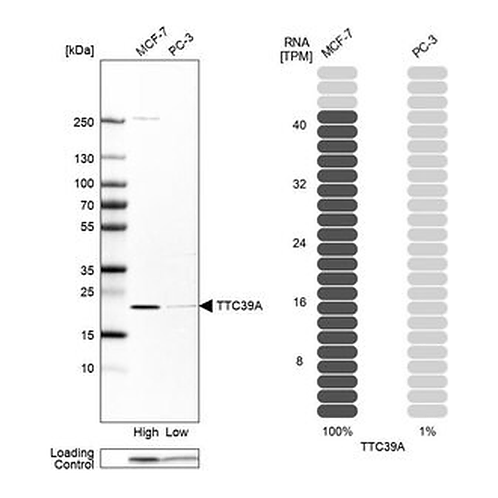 Merck Anti-TTC39A antibody produced in rabbit