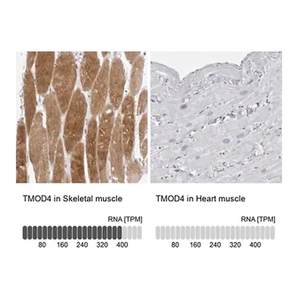 Merck Anti-TMOD4 antibody produced in rabbit