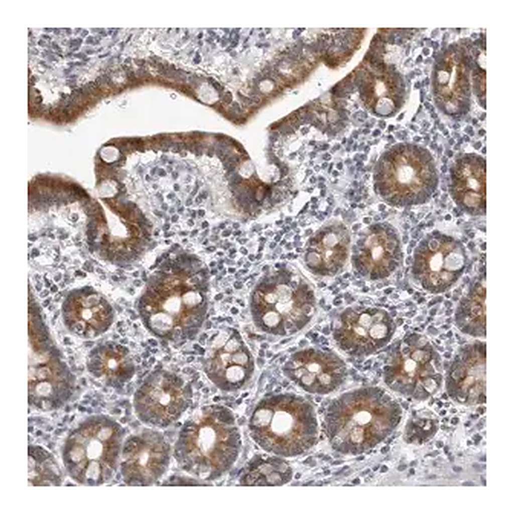 Merck Anti-CPT2 antibody produced in rabbit