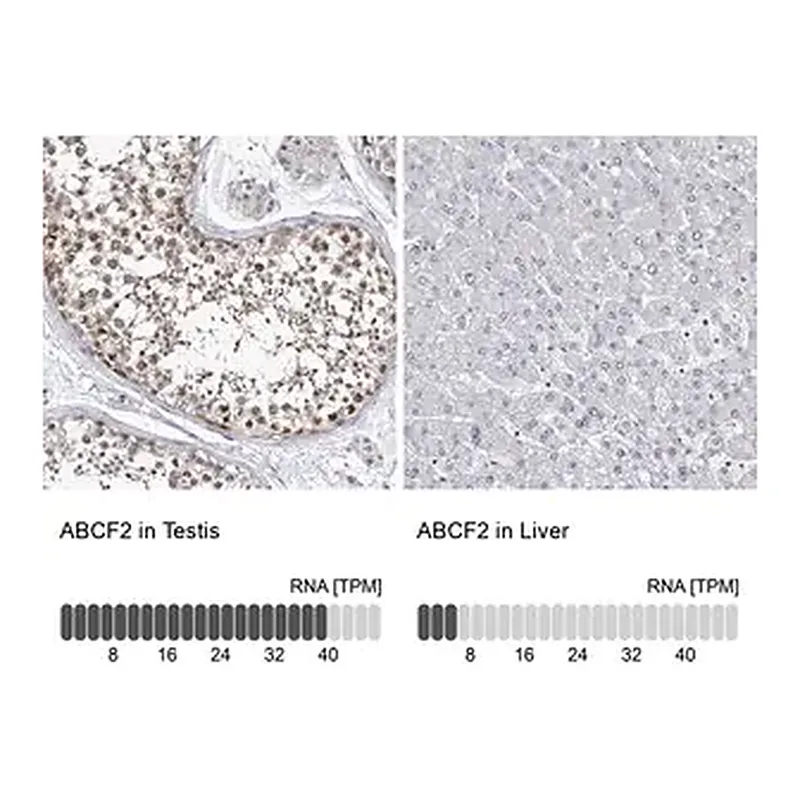 Merck Anti-ABCF2 antibody produced in rabbit