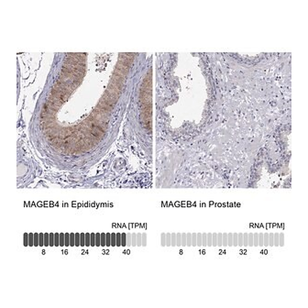 Merck Anti-MAGEB4 antibody produced in rabbit