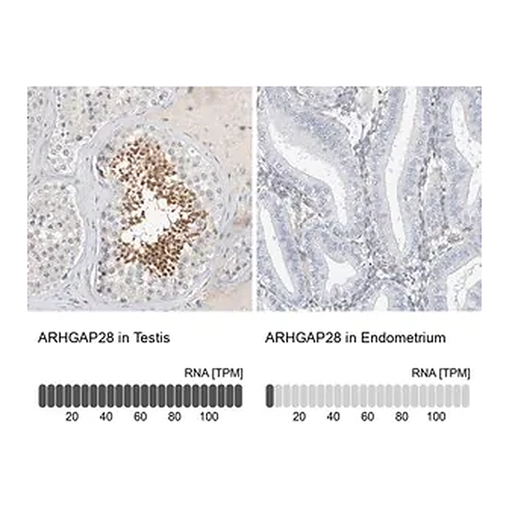 Merck Anti-ARHGAP28 antibody produced in rabbit