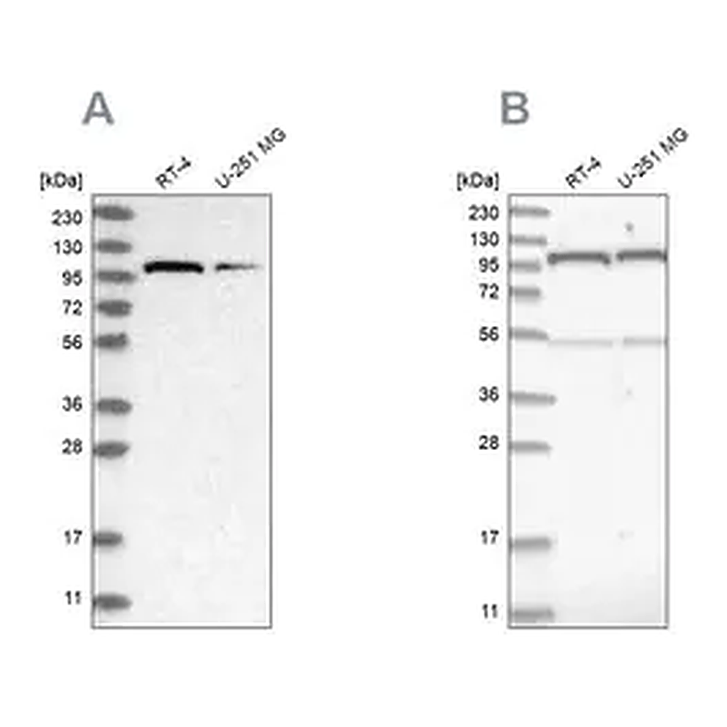 Merck Anti-OGT antibody produced in rabbit
