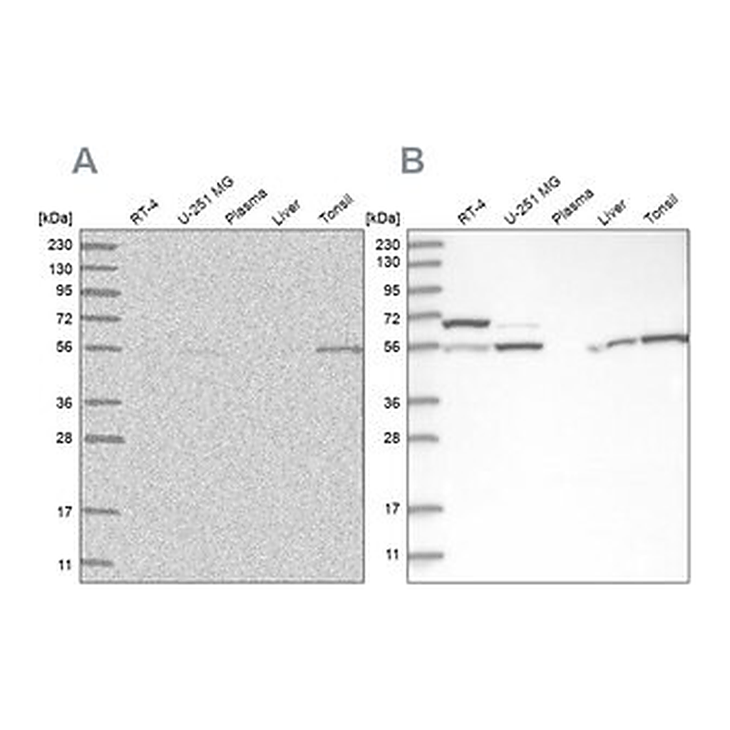 Merck Anti-PPM1F antibody produced in rabbit