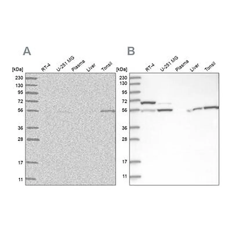 Merck Anti-PPM1F antibody produced in rabbit