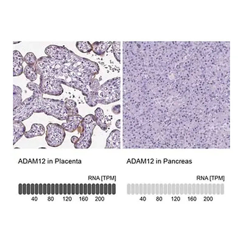 Merck Anti-ADAM12 antibody produced in rabbit