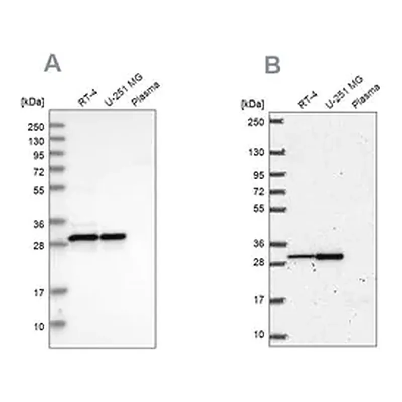 Merck Anti-MRPL28 antibody produced in rabbit