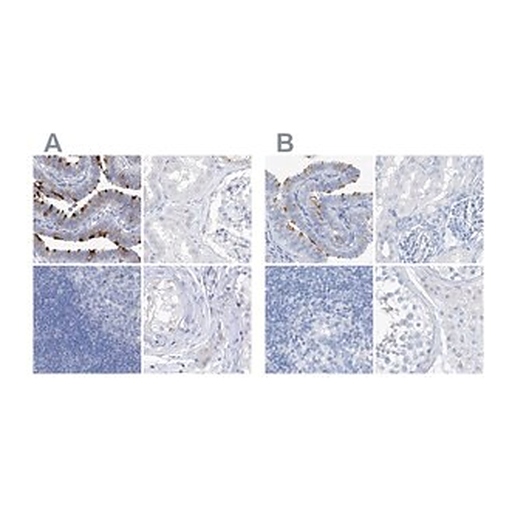 Merck Anti-C1orf87 antibody produced in rabbit