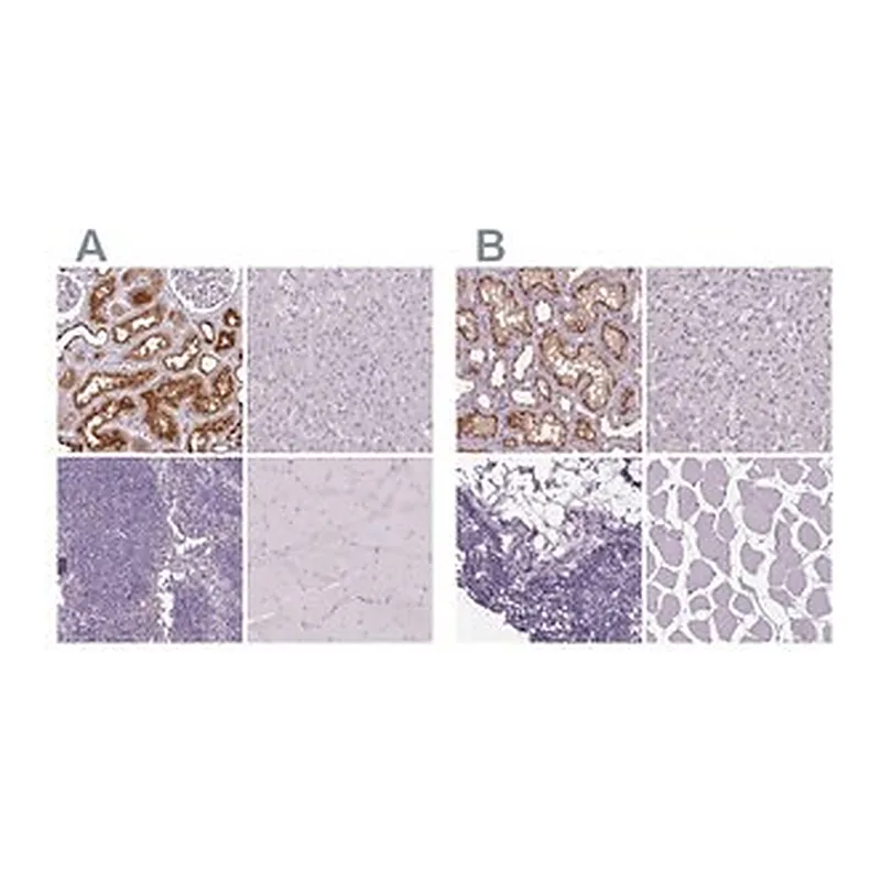 Merck Anti-ATP6V1D antibody produced in rabbit