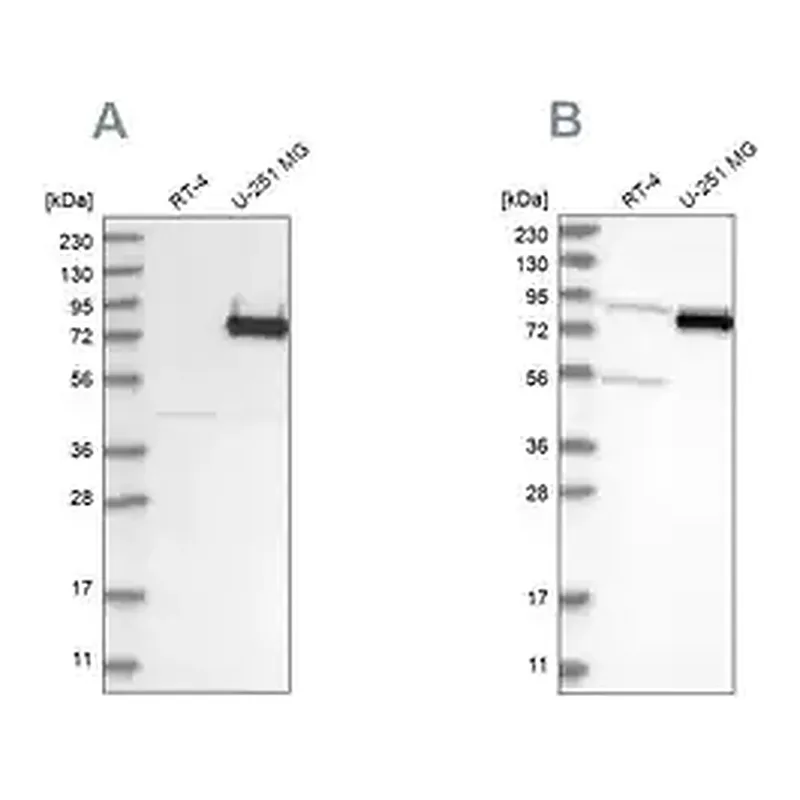 Merck Anti-COLGALT2 antibody produced in rabbit