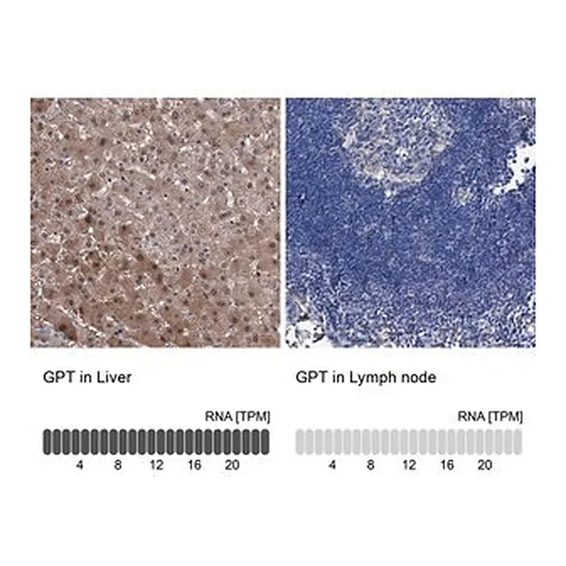 Merck Anti-GPT antibody produced in rabbit