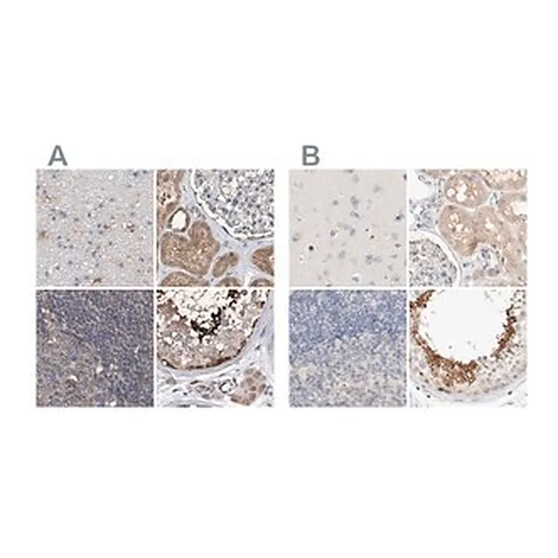 Merck Anti-SPATA20 antibody produced in rabbit