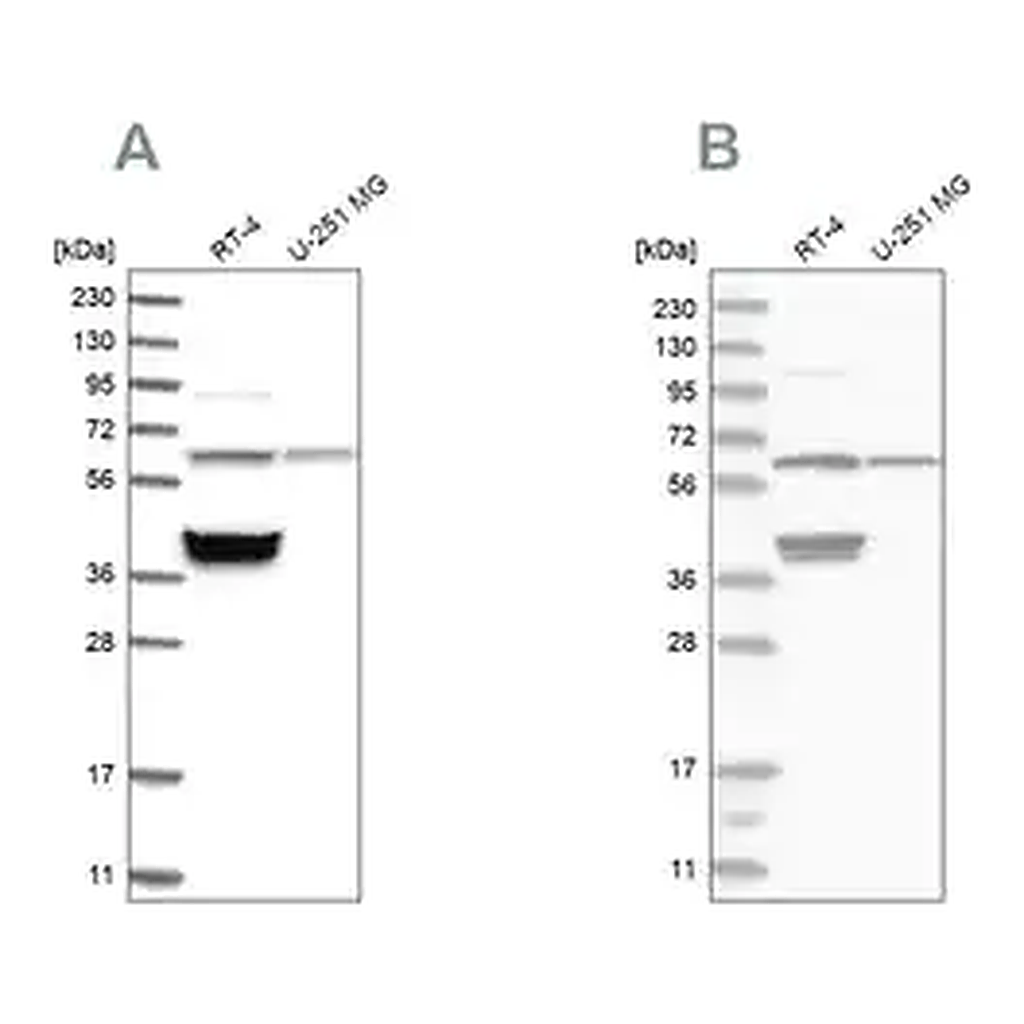 Merck Anti-TCP1 antibody produced in rabbit