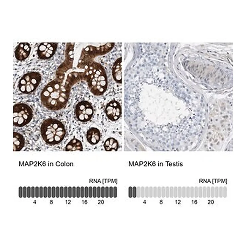 Merck Anti-MAP2K6 antibody produced in rabbit